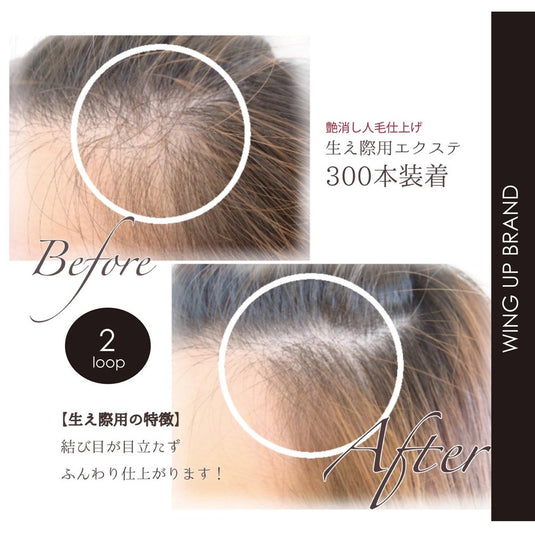 [WING UP] Hair Volume-Up for Hairline 30cm 1000strands (2 loops x 500 bundles))